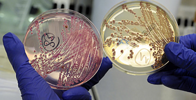 Dos muestras de la bacteria en un laboratorio de Hamburgo. | Reuters