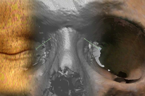 En tres segmentos, la piel, un TAC facial en 3D y el cráneo. | U.G.