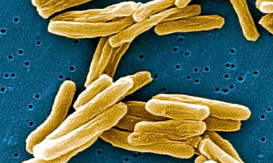 Detalle del bacilo de la tuberculosis bajo el microscopio. | EL MUNDO