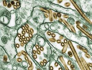 Imagen del virus H5N1, en amarillo (Foto: CDC | C. Goldsmith)