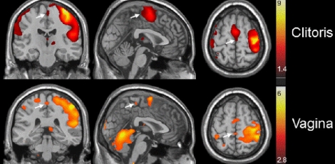 El cerebro se activa de manera diferente según el área estimulada. | Foto: Barry Komisaruk El cerebro se activa de manera diferente según el área estimulada. | Foto: Barry Komisaruk