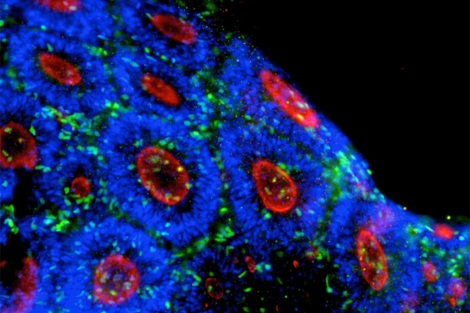 Neuronas de células iPS. | Dolmetsch Lab, Stanford University, Alfredo Cabrera Socorro