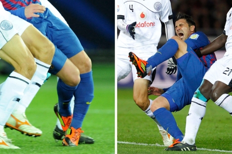 Imágenes de la lesión de David Villa. | Reuters | Efe