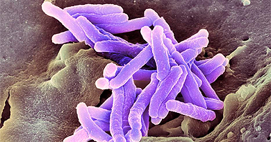 Detalle del bacilo de la tuberculosis , ‘Mycobacterium tuberculosis'